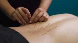 Đau Lưng: Châm Cứu Hay Uống? Giải Pháp Toàn Diện Cho Xương Khớp