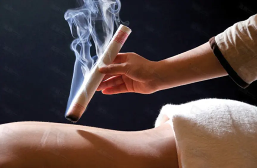 Cứu Ngải (Moxibustion): Liệu Pháp Truyền Thống Từ Y Học Cổ Truyền