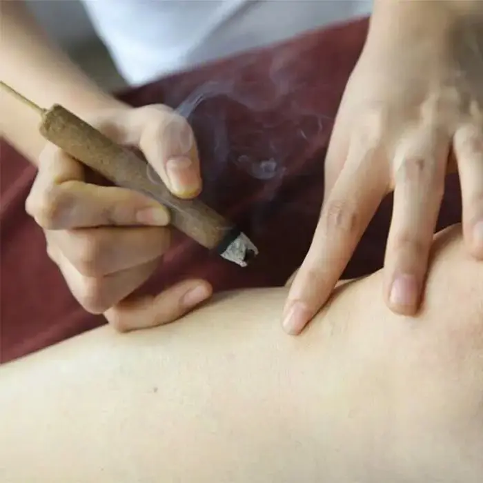 Điếu ngải cứu được sử dụng để hơ nóng huyệt đạo theo nguyên lý ôn kinh tán hàn của YHCT